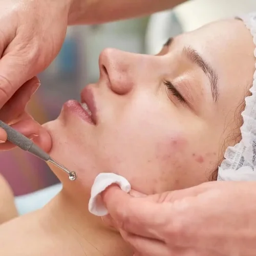 Anti-Aging Facial